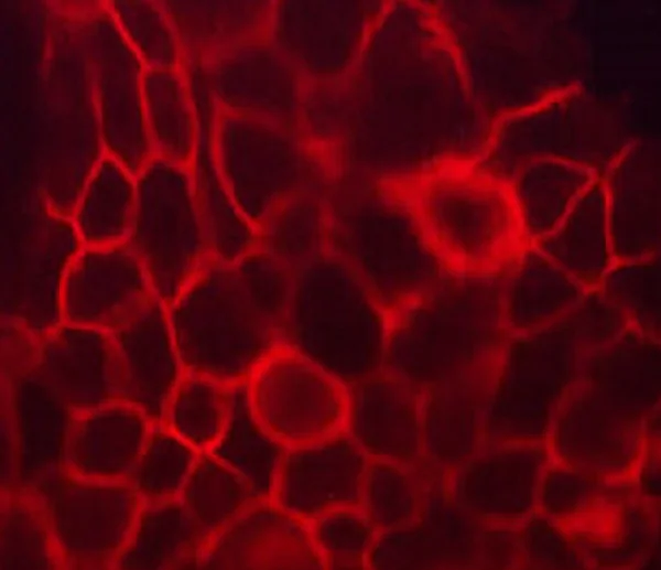 Immunocytochemistry/ Immunofluorescence - Anti-CD44 antibody [M007] - Extracellular domain (AB253275)