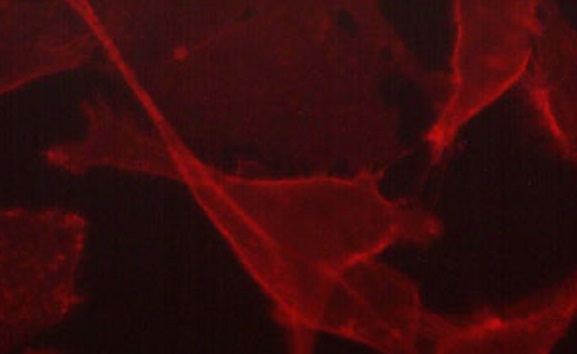 Immunocytochemistry/ Immunofluorescence - Anti-CD44 antibody [M588] (AB253278), expandable thumbnail