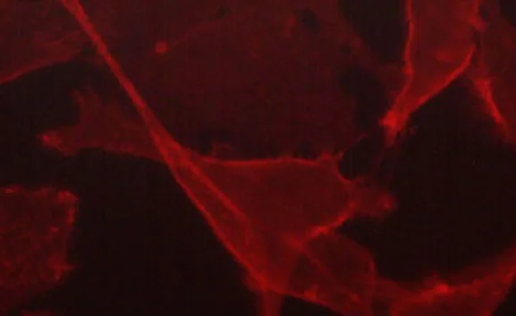 Immunocytochemistry/ Immunofluorescence - Anti-CD44 antibody [M588] (AB253278)