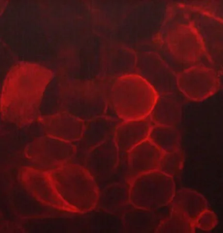 Immunocytochemistry/ Immunofluorescence - Anti-CD44 antibody [M591] (AB253279)