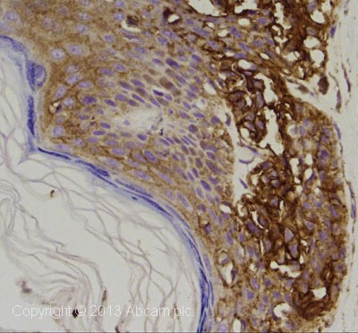 Immunohistochemistry (Formalin/PFA-fixed paraffin-embedded sections) - Anti-CD44 antibody [MEM-263] (AB9524)