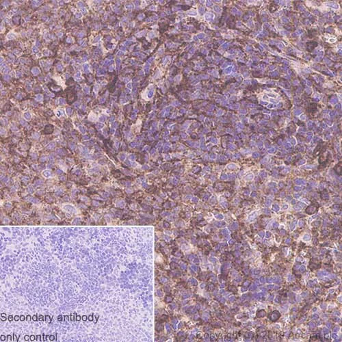 Immunohistochemistry (Formalin/PFA-fixed paraffin-embedded sections) - Anti-CD44 antibody [OX49] - BSA and Azide free (AB244580)