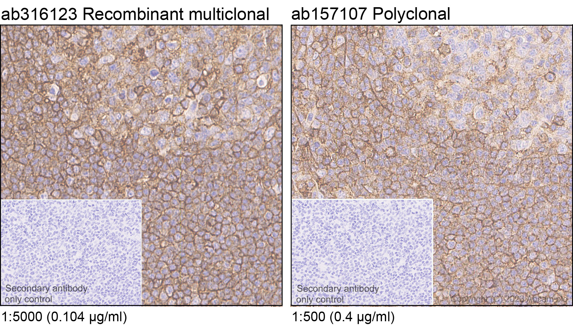 Immunohistochemistry (Formalin/PFA-fixed paraffin-embedded sections) - Anti-CD44 antibody [RM1084] (ab316123), expandable thumbnail