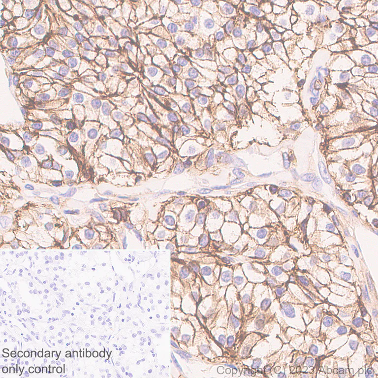 Immunohistochemistry (Formalin/PFA-fixed paraffin-embedded sections) - Anti-CD44 antibody [RM1084] (AB316123)