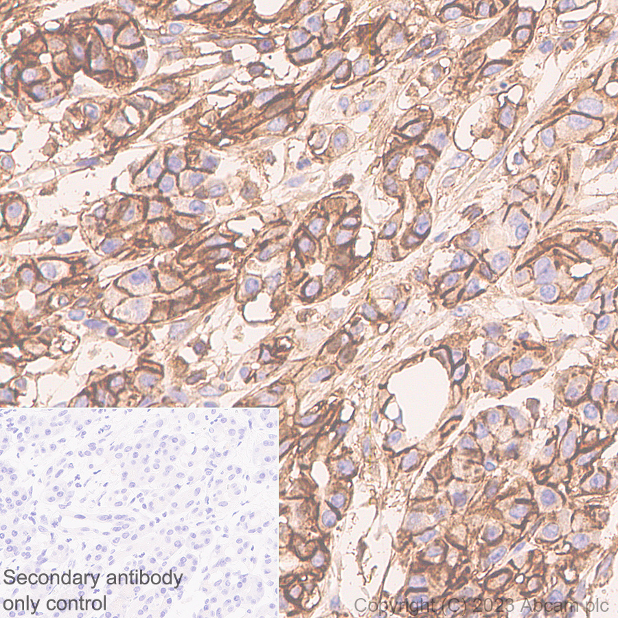 Immunohistochemistry (Formalin/PFA-fixed paraffin-embedded sections) - Anti-CD44 antibody [RM1084] (ab316123), expandable thumbnail