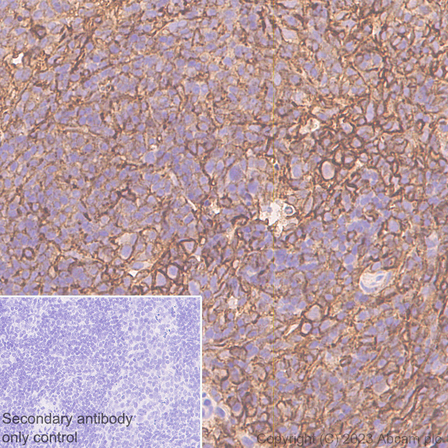 Immunohistochemistry (Formalin/PFA-fixed paraffin-embedded sections) - Anti-CD44 antibody [RM1084] (AB316123), expandable thumbnail