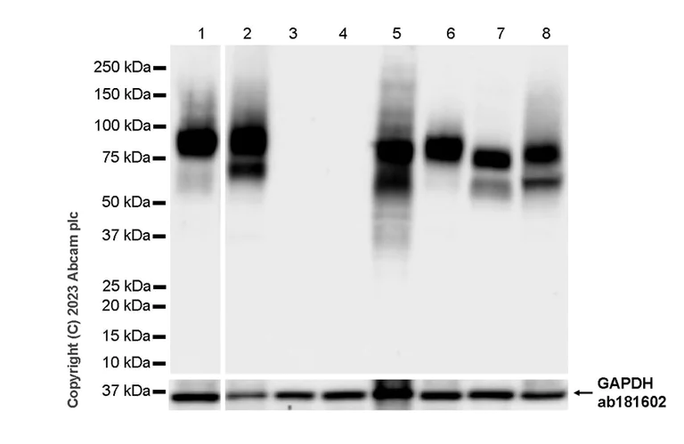 Western blot - Anti-CD44 antibody [RM1084] (AB316123)