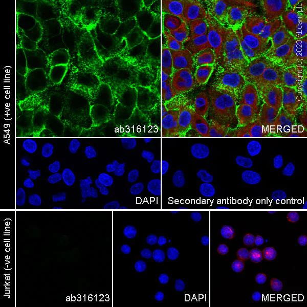 Immunocytochemistry/ Immunofluorescence - Anti-CD44 antibody [RM1084] - BSA and Azide free (AB316124)