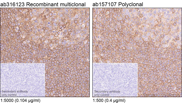 Immunohistochemistry (Formalin/PFA-fixed paraffin-embedded sections) - Anti-CD44 antibody [RM1084] - BSA and Azide free (AB316124)