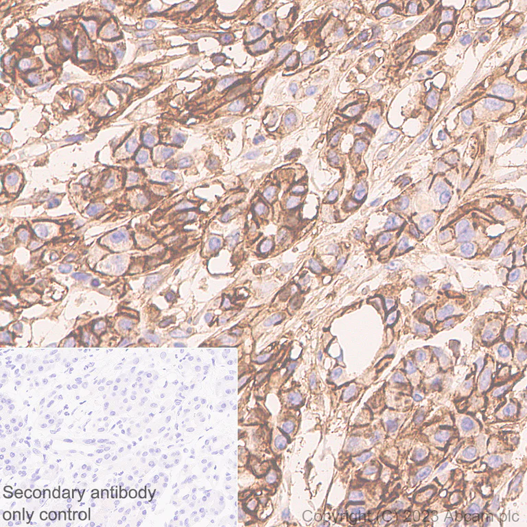 Immunohistochemistry (Formalin/PFA-fixed paraffin-embedded sections) - Anti-CD44 antibody [RM1084] - BSA and Azide free (AB316124)