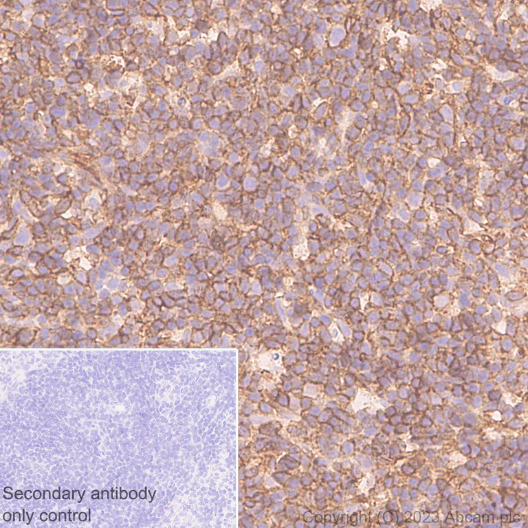 Immunohistochemistry (Formalin/PFA-fixed paraffin-embedded sections) - Anti-CD44 antibody [RM1084] - BSA and Azide free (AB316124)