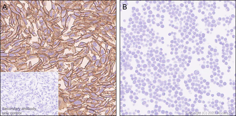 Immunohistochemistry (Formalin/PFA-fixed paraffin-embedded sections) - Anti-CD44 antibody [RM1084] - BSA and Azide free (AB316124)