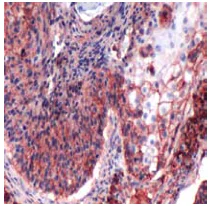 Immunohistochemistry (Formalin/PFA-fixed paraffin-embedded sections) - Anti-CD44 antibody [SP37] (AB101531)