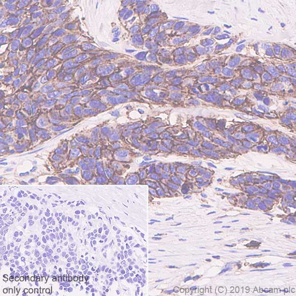 Immunohistochemistry (Formalin/PFA-fixed paraffin-embedded sections) - Anti-CD44 antibody [SP37] (AB101531)