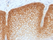 Immunohistochemistry (Formalin/PFA-fixed paraffin-embedded sections) - Anti-CD44v4 antibody [CD44v4/1700R] (AB217904), expandable thumbnail
