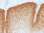 Immunohistochemistry (Formalin/PFA-fixed paraffin-embedded sections) - Anti-CD44v4 antibody [CD44v4/1700R] (AB217904)
