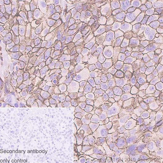 Immunohistochemistry (Formalin/PFA-fixed paraffin-embedded sections) - Anti-CD44v6 antibody [2F10] - BSA and Azide free (AB255931)