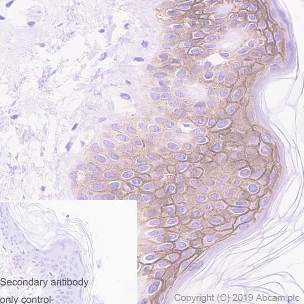 Immunohistochemistry (Formalin/PFA-fixed paraffin-embedded sections) - Anti-CD44v6 antibody [2F10] - BSA and Azide free (AB255931)
