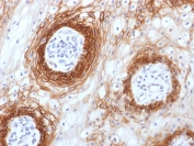 Immunohistochemistry (Formalin/PFA-fixed paraffin-embedded sections) - Anti-CD44v6 antibody [CD44v6/1246] (AB217902)