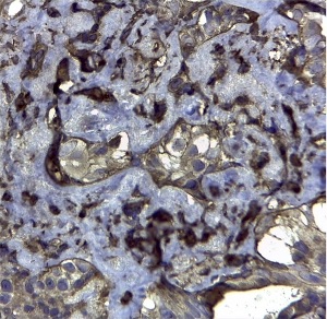 Immunohistochemistry (Formalin/PFA-fixed paraffin-embedded sections) - Anti-CD44v6 antibody [VFF-7] (AB30436)