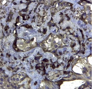 Immunohistochemistry (Formalin/PFA-fixed paraffin-embedded sections) - Anti-CD44v6 antibody [VFF-7] (AB30436)