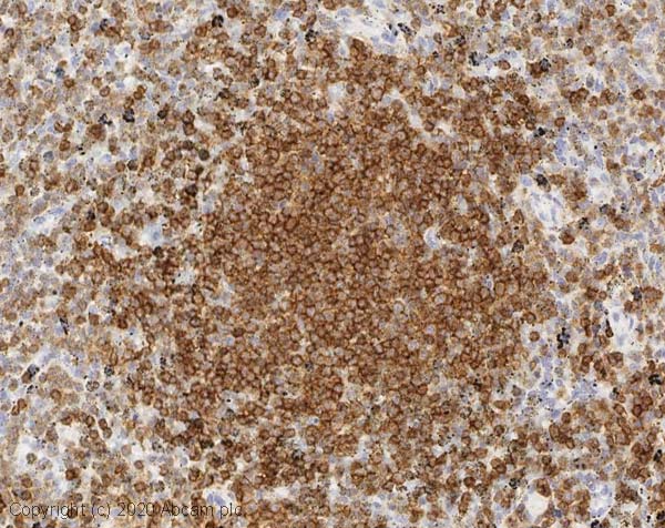 Immunohistochemistry (Formalin/PFA-fixed paraffin-embedded sections) - Anti-CD45 antibody (ab10558), expandable thumbnail