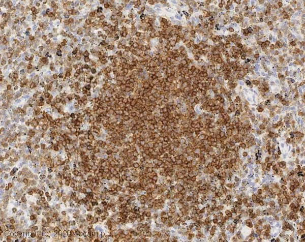 Immunohistochemistry (Formalin/PFA-fixed paraffin-embedded sections) - Anti-CD45 antibody (AB10558)