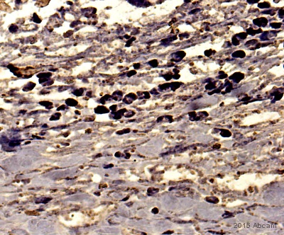 Immunohistochemistry (Formalin/PFA-fixed paraffin-embedded sections) - Anti-CD45 antibody (ab10558), expandable thumbnail