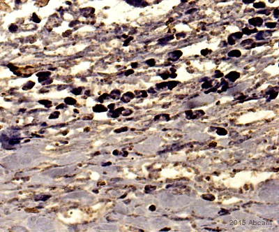 Immunohistochemistry (Formalin/PFA-fixed paraffin-embedded sections) - Anti-CD45 antibody (AB10558)
