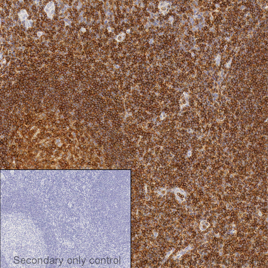 Immunohistochemistry (Formalin/PFA-fixed paraffin-embedded sections) - Anti-CD45 antibody (AB10558), expandable thumbnail