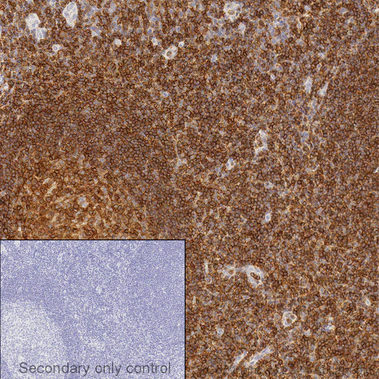 Anti-CD45 抗体 (ab10558) | Abcam