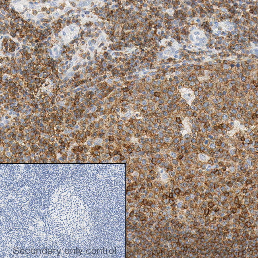 Immunohistochemistry (Formalin/PFA-fixed paraffin-embedded sections) - Anti-CD45 antibody (ab10558), expandable thumbnail