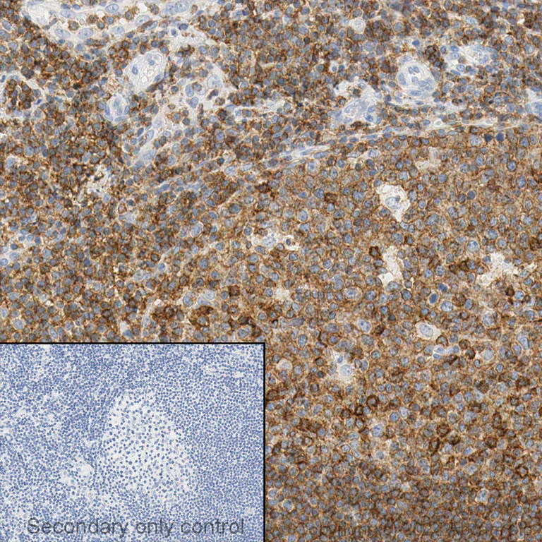 Immunohistochemistry (Formalin/PFA-fixed paraffin-embedded sections) - Anti-CD45 antibody (AB10558)
