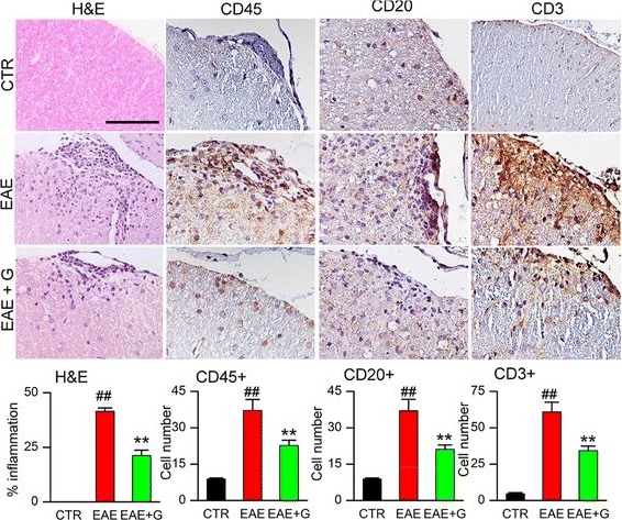 Immunohistochemistry (Formalin/PFA-fixed paraffin-embedded sections) - Anti-CD45 antibody (ab10558), expandable thumbnail