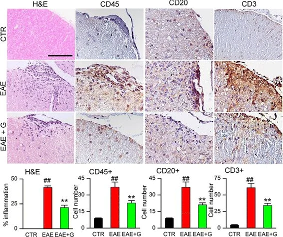 Immunohistochemistry (Formalin/PFA-fixed paraffin-embedded sections) - Anti-CD45 antibody (AB10558)