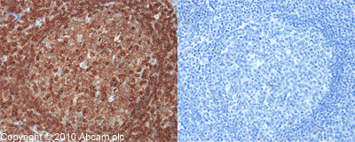 Immunohistochemistry (Formalin/PFA-fixed paraffin-embedded sections) - Anti-CD45 antibody (AB10558), expandable thumbnail