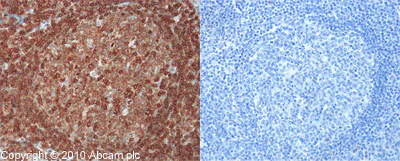 Immunohistochemistry (Formalin/PFA-fixed paraffin-embedded sections) - Anti-CD45 antibody (AB10558)