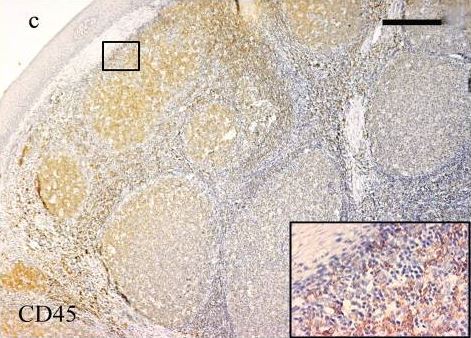 Immunohistochemistry (Formalin/PFA-fixed paraffin-embedded sections) - Anti-CD45 antibody (AB10558), expandable thumbnail