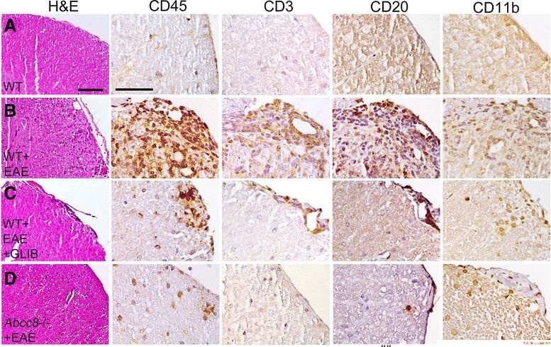 Immunohistochemistry - Anti-CD45 antibody (ab10558), expandable thumbnail