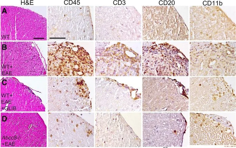 Immunohistochemistry - Anti-CD45 antibody (AB10558)