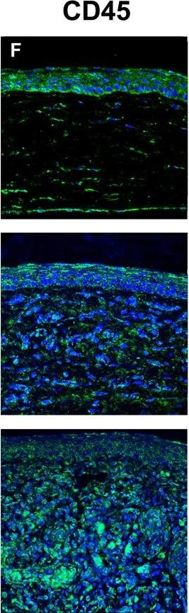 Immunohistochemistry - Anti-CD45 antibody (AB10558)
