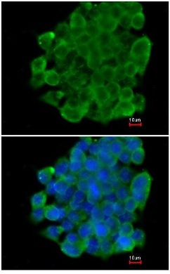 Immunocytochemistry/ Immunofluorescence - Anti-CD45 antibody (AB154885), expandable thumbnail