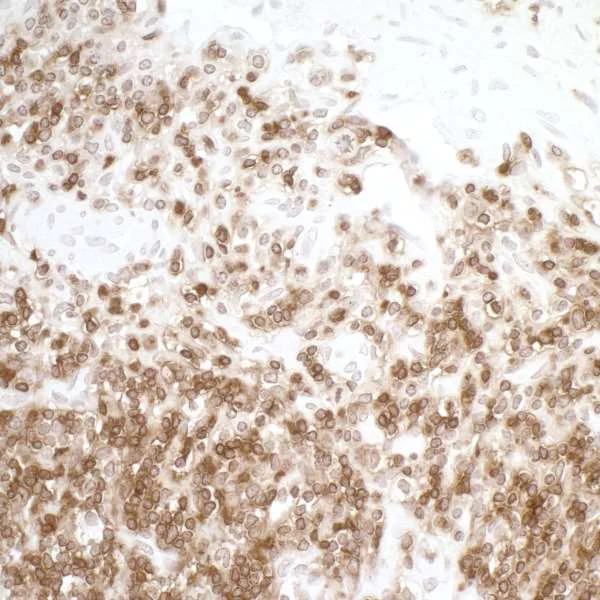 Immunohistochemistry (Formalin/PFA-fixed paraffin-embedded sections) - Anti-CD45 antibody [BL-178-12C7] (AB243869)