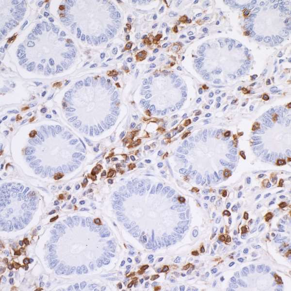 Immunohistochemistry (Formalin/PFA-fixed paraffin-embedded sections) - Anti-CD45 antibody [BL-178-12C7] (AB243869)