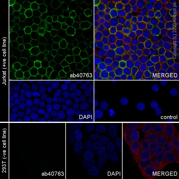Immunocytochemistry/ Immunofluorescence - Anti-CD45 antibody [EP322Y] (AB40763)