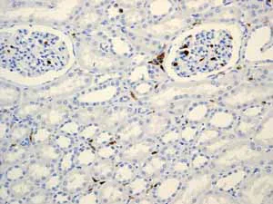 Immunohistochemistry (Formalin/PFA-fixed paraffin-embedded sections) - Anti-CD45 antibody [EP322Y] (AB40763)