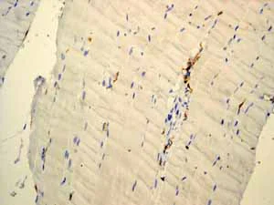 Immunohistochemistry (Formalin/PFA-fixed paraffin-embedded sections) - Anti-CD45 antibody [EP322Y] (AB40763)