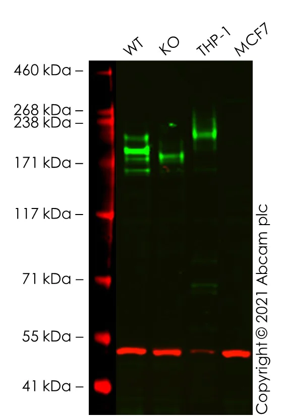 Western blot - Anti-CD45 antibody [EP322Y] (AB40763)
