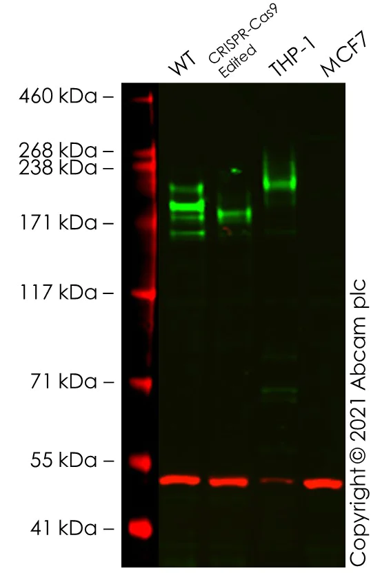 Western blot - Anti-CD45 antibody [EP322Y] (AB40763)