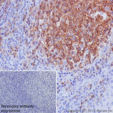 Immunohistochemistry (Formalin/PFA-fixed paraffin-embedded sections) - Anti-CD45 antibody [EP322Y] - BSA and Azide free (AB214437)